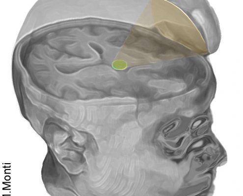 Martin Monti (brain image, Aug. 2016)