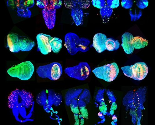 A photo of images of fruit flies’ eyes, wings and lymph glands.