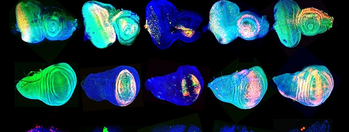 A photo of images of fruit flies’ eyes, wings and lymph glands.