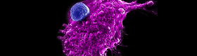 Image of an engineered HSC-iNKT cell (blue) attacking a human tumor cell. Photo Credit: Yang Lab/UCLA