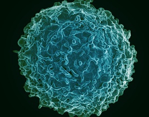 Colorized scanning electron micrograph of a human B cell