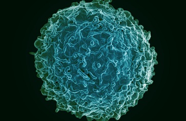 Colorized scanning electron micrograph of a human B cell