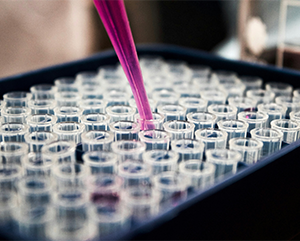URW-beaker-363-241 A close-up view of a laboratory setting, showcasing a pipette dispensing a liquid into one of the many small, clear tubes arranged in a tray. The tray is dark blue, and the background is blurred, emphasizing the precision of the experiment in progress.