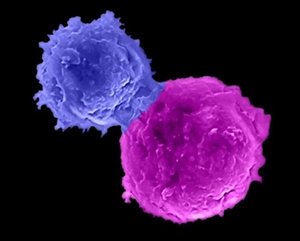 lili+yang+nature-363-241 A microscopy image shows an enhanced natural killer T cell (blue) attacking a human multiple myeloma cell (magenta).