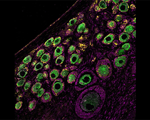 A microscopy image of the outer region of the rhesus macaque ovary in green, yellow and magenta