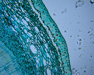 the-drug-5197202_1280-363-241 Microscopic view of a cell stained in blue and green, showing distinct cellular layers including the epidermis, cortex, and vascular bundles.