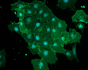 pablo cell image newsroom size – 363 – 241 Stem cell-derived blood-brain barrier cells.